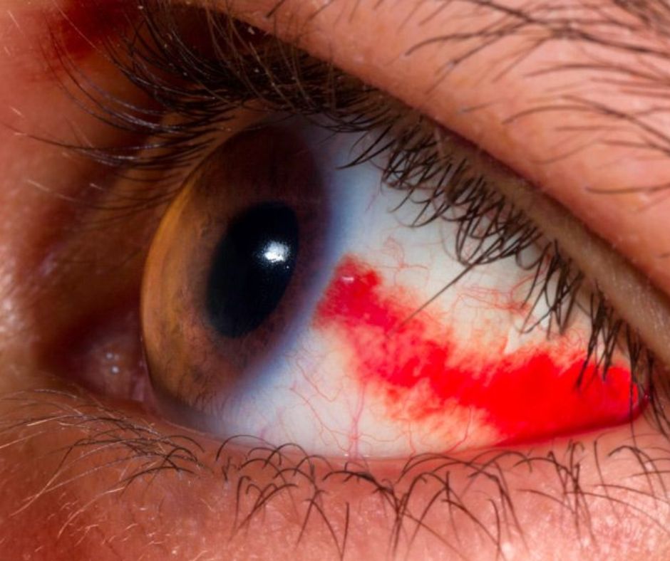 How Eye Diseases Affect Your Vision and What You Can Do About It