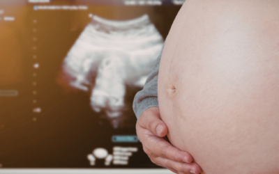 Thinking About an Early Pregnancy Scan? Here’s What Every Parent-to-Be Should Know