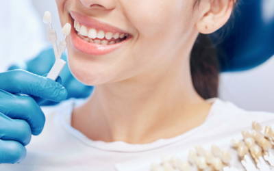 Dental Crowns Explained From Tooth Damage to Complete Restoration