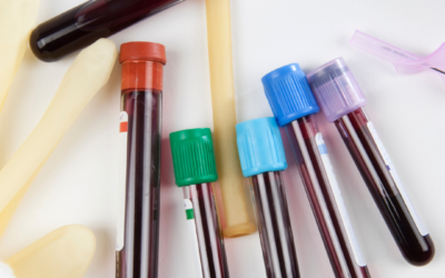 How Same Day Blood Tests Can Make Routine Health Screening Faster and More Convenient