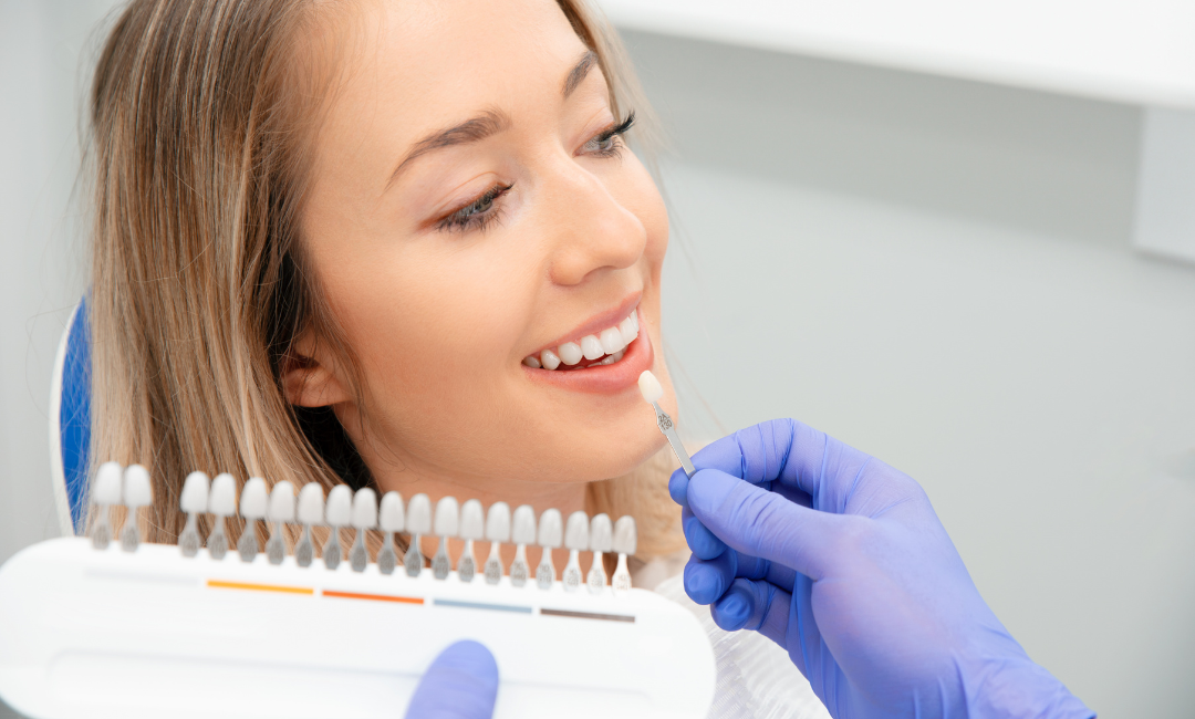 dental veneers in Penrith